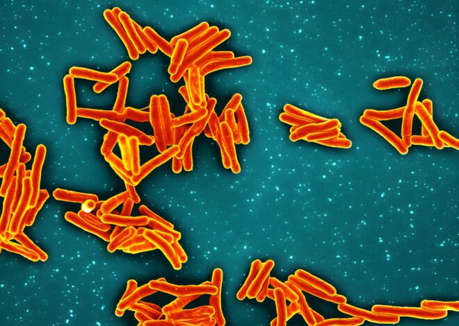 ‘This is a big outbreak’: Nearly 1 in 5 affected by TB at SF school