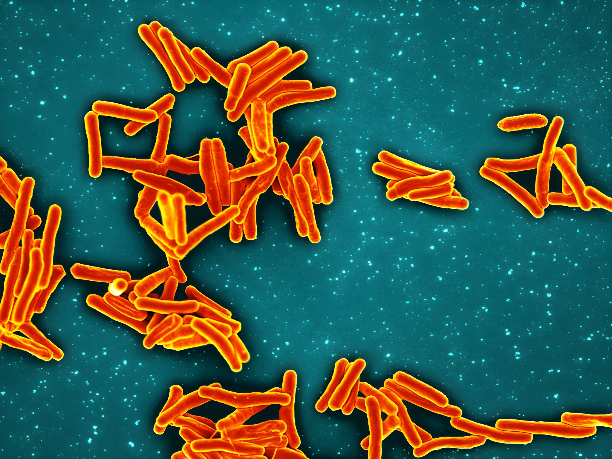 ‘This is a big outbreak’: Nearly 1 in 5 affected by TB at SF school