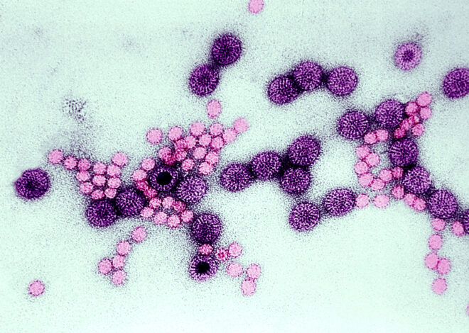 The Bay Area towns hit hardest by a highly contagious diarrheal illness
