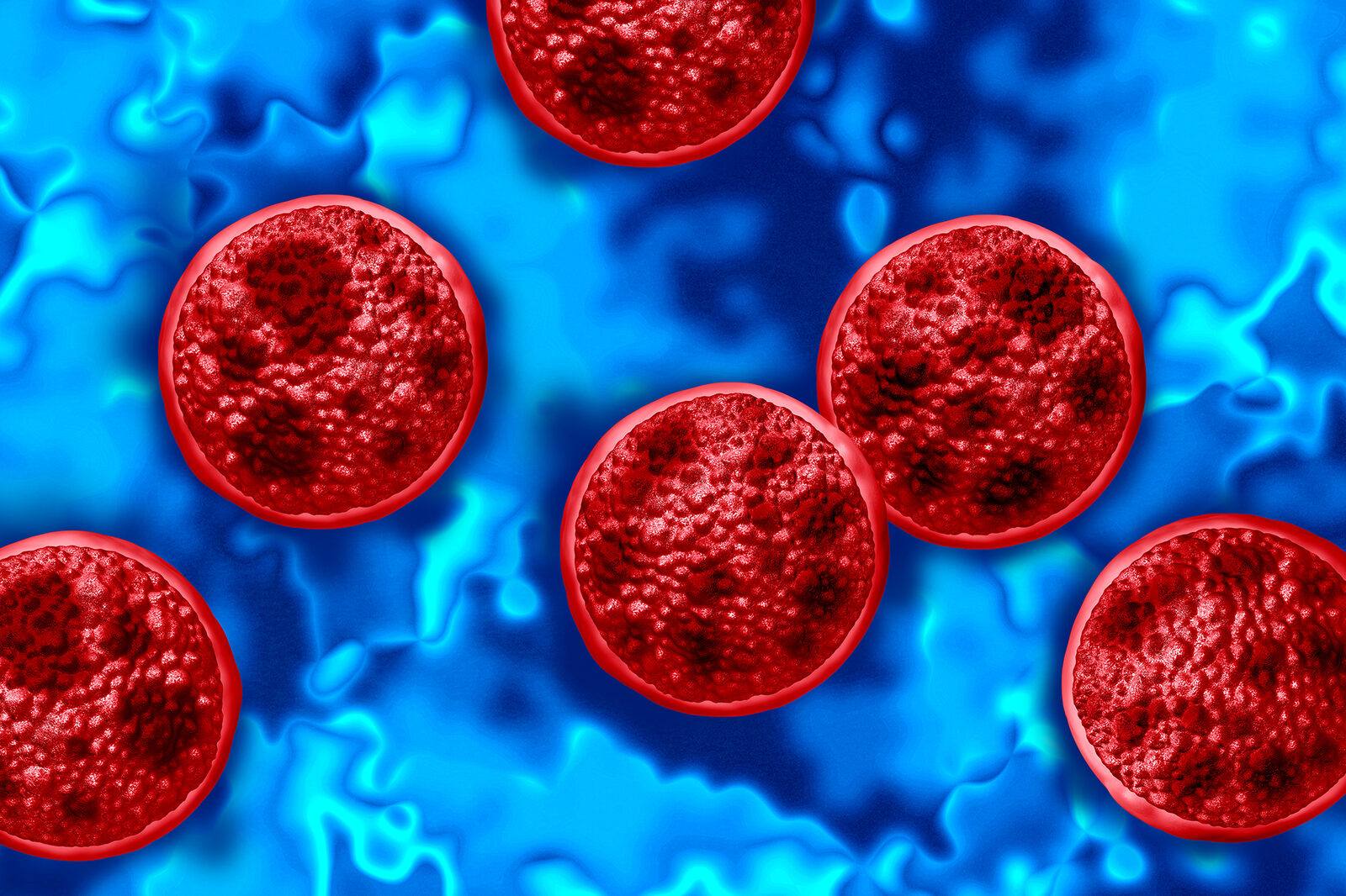 Diarrhea-causing disease hits double average cases in California
