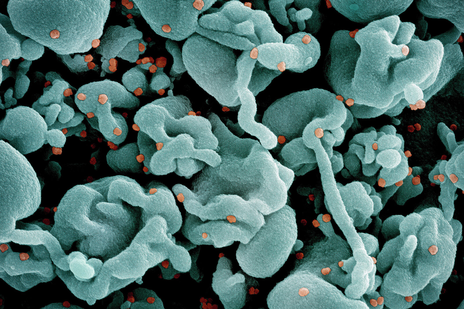 Mutated COVID-19 variant could be behind surge in SF virus levels