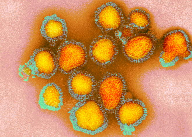 ‘Game on’: Bay Area now epicenter of California flu cases