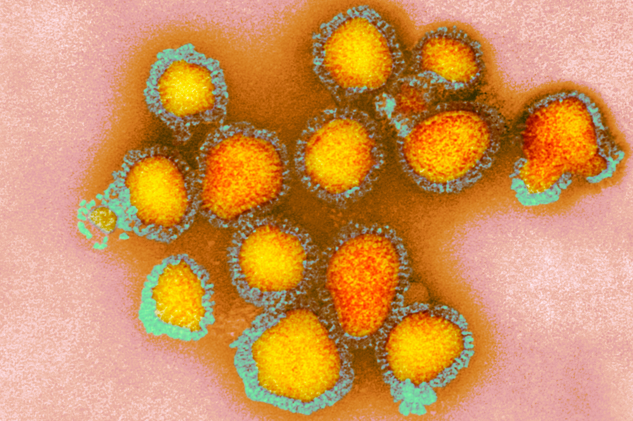 ‘Game on’: Bay Area now epicenter of California flu cases